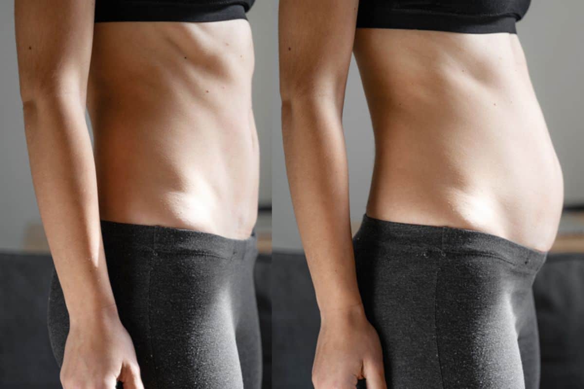 How long does diastasis recti take to improve Liphook?