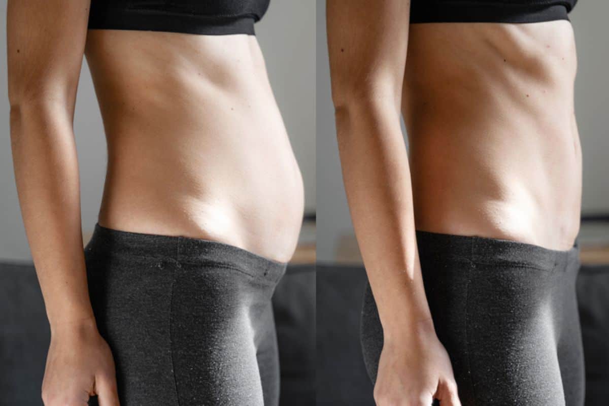 Post-Pregnancy: What Happens to Your Abdominal Muscles After Birth Liphook