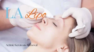 Woman receiving Actinic Keratosis Removal Treatment Liphook
