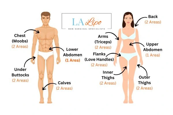 LA LIPO Cryolipolysis Areas Liphook