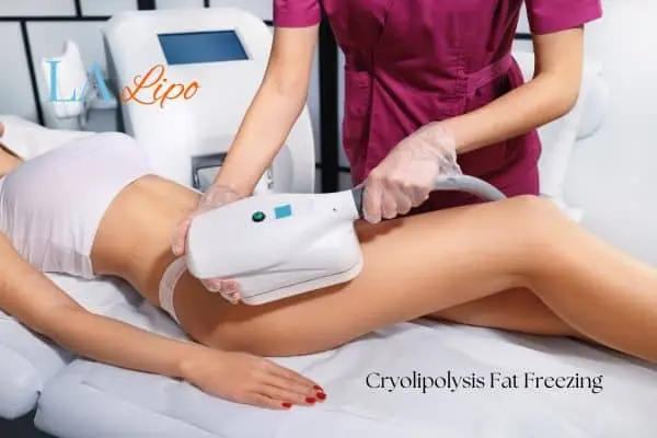 Woman receiving coolsculpting Liphook treatment on her thighs