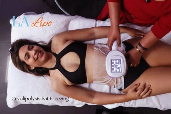 woman getting cryolipolysis Liphook