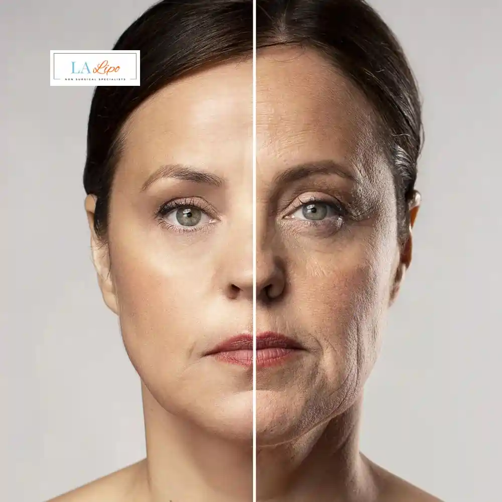 How Can You Tell If Non-Surgical Skin Tightening Is Right for You Liphook?
