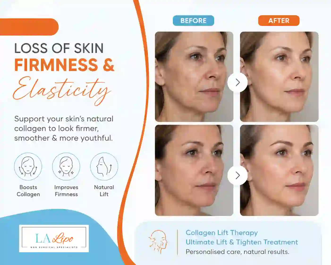 Sign #7: Loss of Skin Firmness and Elasticity Liphook