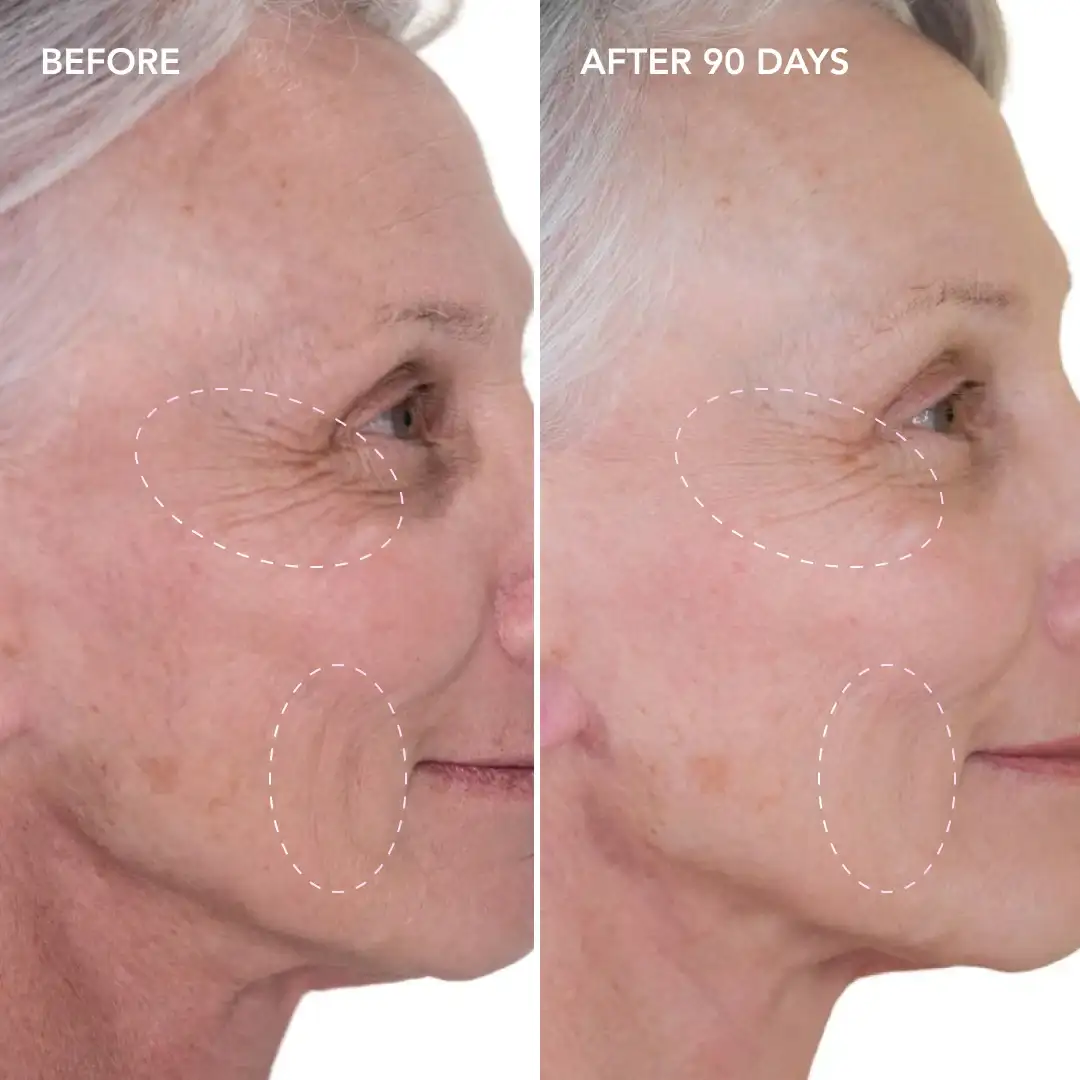 When will you see results Liphook